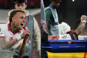 手指被割成重伤！诺阿·朗：我的大拇指还连在手上，，，，，，医生说能保住_24直播网