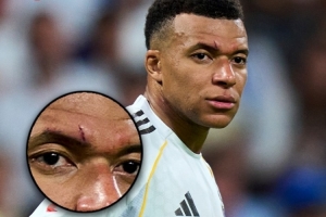 脸部挂花！TA：姆巴佩预计能首发出战皇马对拜仁的欧冠_24直播网