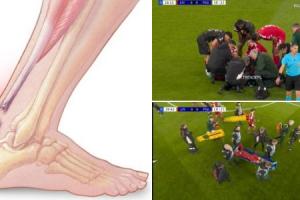 天下杯危！康复专家：埃；；；倏丝赡苁歉於狭，，，，，将缺席9-12个月_24直播网